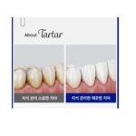 MEDIAN Tartar Toothpaste White - 210g - Image 2