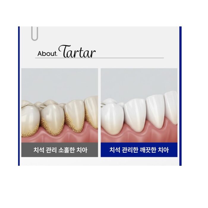 MEDIAN Tartar Toothpaste White - 210g - Image 2