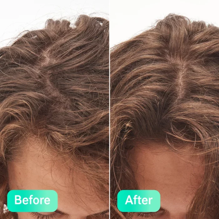 ⁦The INKEY List Glycolic Acid Exfoliating Scalp Scrub 150ml⁩ - الصورة ⁦10⁩