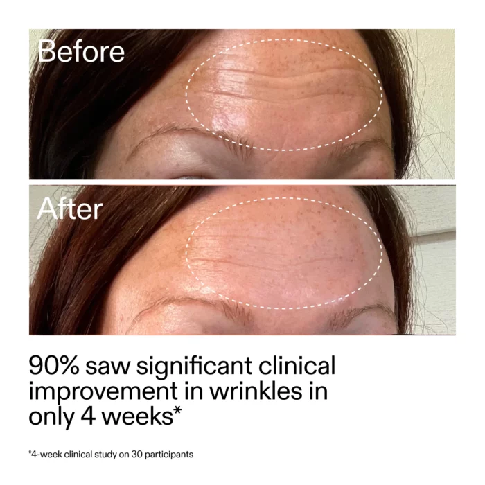 ⁦The inkey list Starter Retinol Serum 30ML⁩ - الصورة ⁦8⁩
