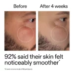 ⁦The inkey list Starter Retinol Serum 30ML⁩ - الصورة ⁦10⁩