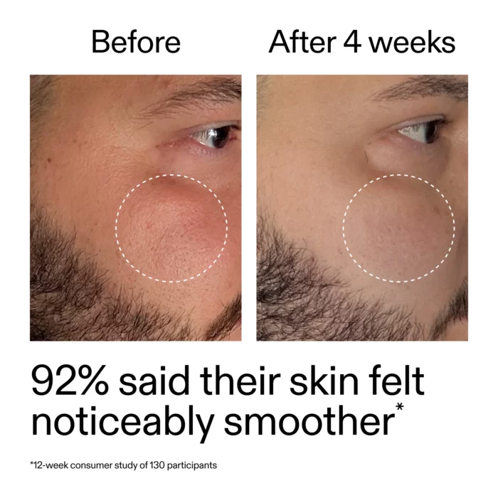 ⁦The inkey list Starter Retinol Serum 30ML⁩ - الصورة ⁦10⁩