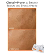 Dr. Dennis Gross Alpha Beta® Universal Daily Peel – 3 Treatments - Image 3