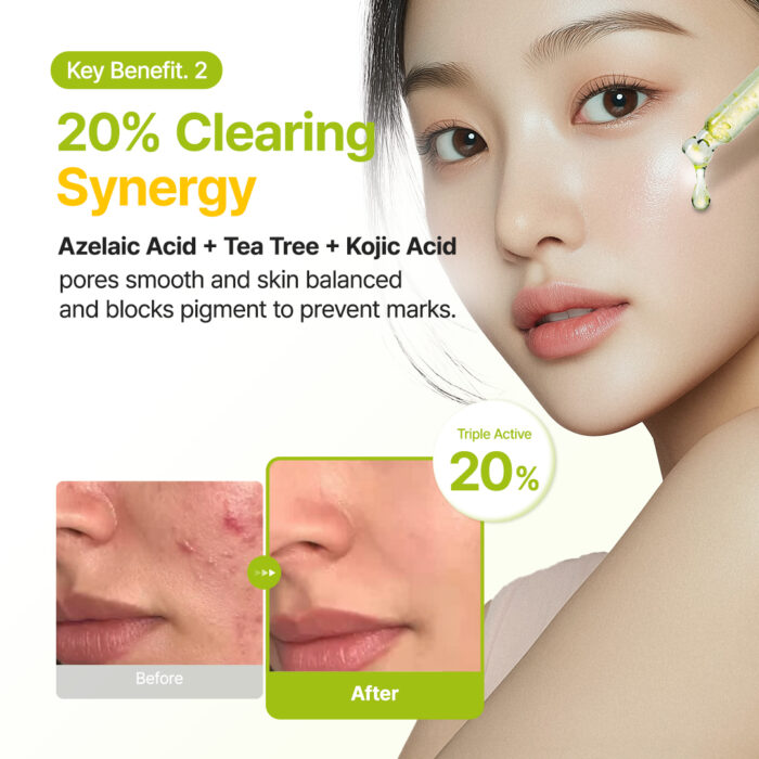 PURITO Seoul Azelaic Acid 10 Kojic Tea Tree Serum - 30ml - Image 2