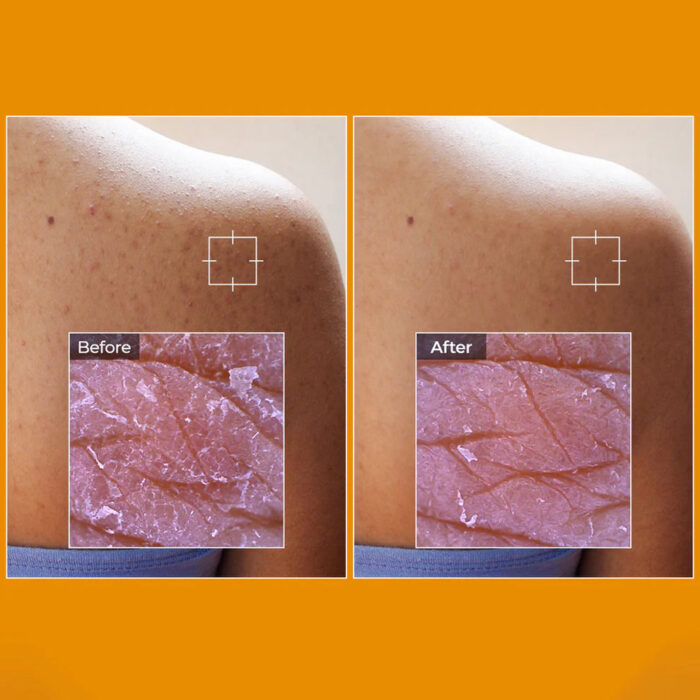Dr.Melaxin TX-Kojic Acid Turmeric Toner Pad – 70 Pads / 190 ml - Image 7