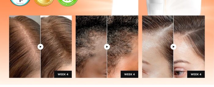 ⁦Lilyeve
Grow:Turn Exosome Brush Ampoule 30ml⁩ - الصورة ⁦2⁩