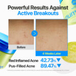 The numbuzin No.0 Zero Blemish Azela Cica Balancing Dual Pads - Image 4