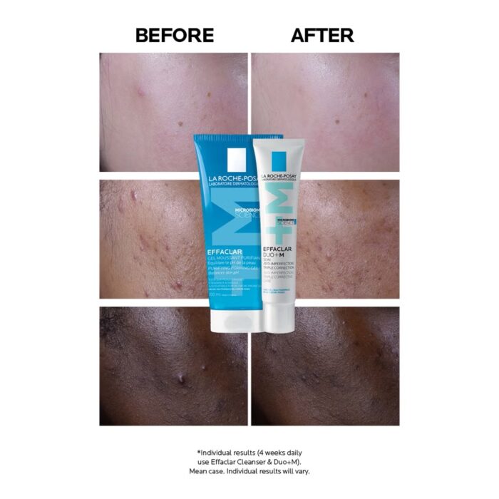 La Roche-Posay Effaclar Duo+M Anti-Blemish Corrective Gel Moisturiser for Oily, Blemish-Prone Skin 40ml - Image 2